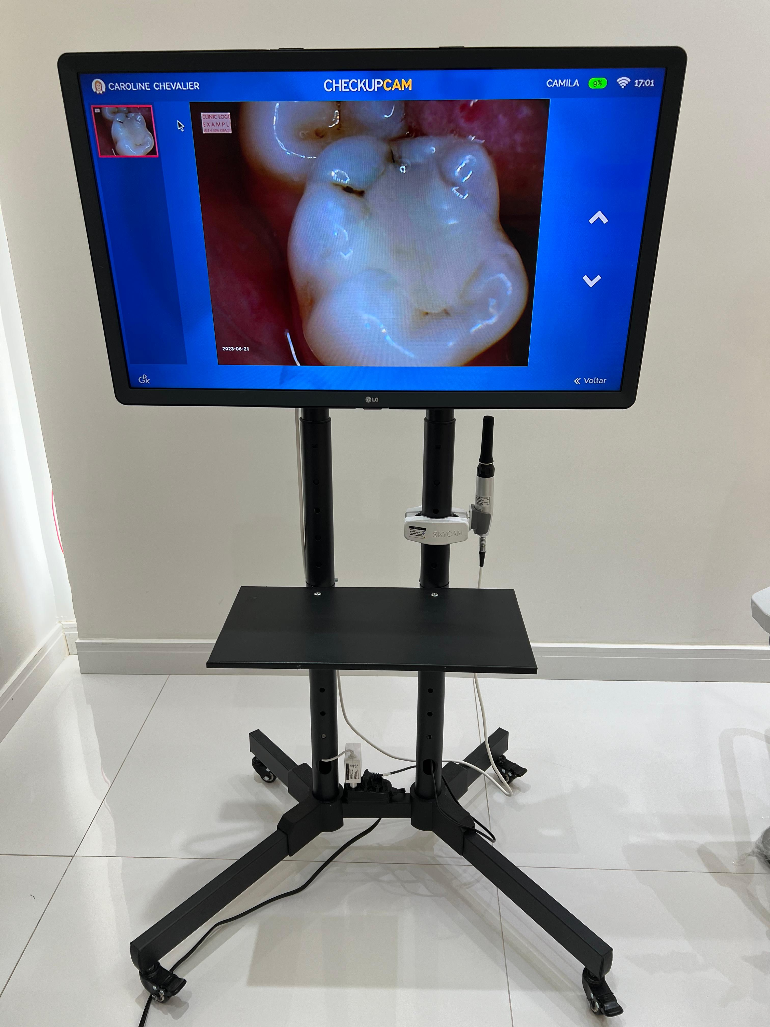 Câmera intraoral - dentista 1